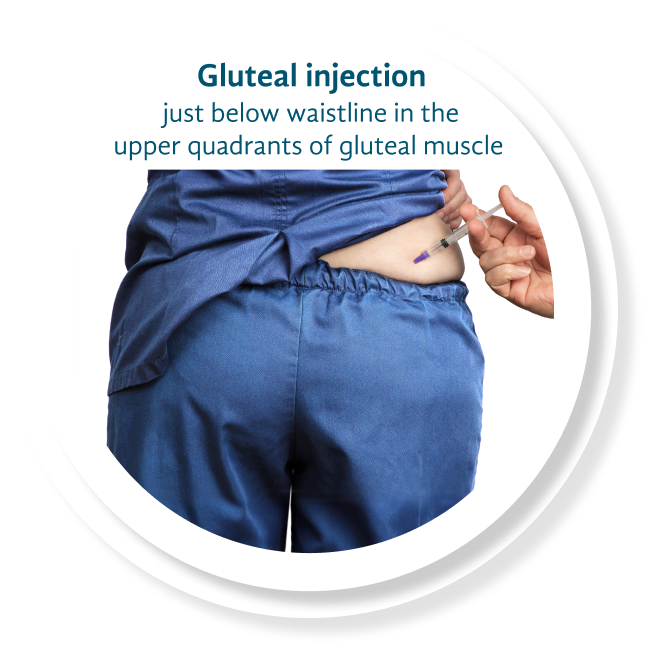 Gluteal injection example